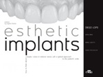 Esthetic implants. How to think about complex cases in anterior areas with a global approach to the patient' s smile Ebook di  Diego Lops, Mario Gisotti, Guido Picciocchi, Irfan Abas